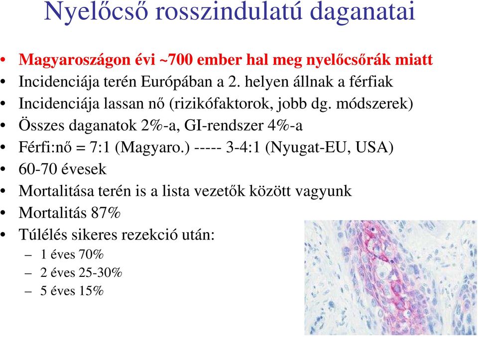 módszerek) Összes daganatok 2%-a, GI-rendszer 4%-a Férfi:nő = 7:1 (Magyaro.