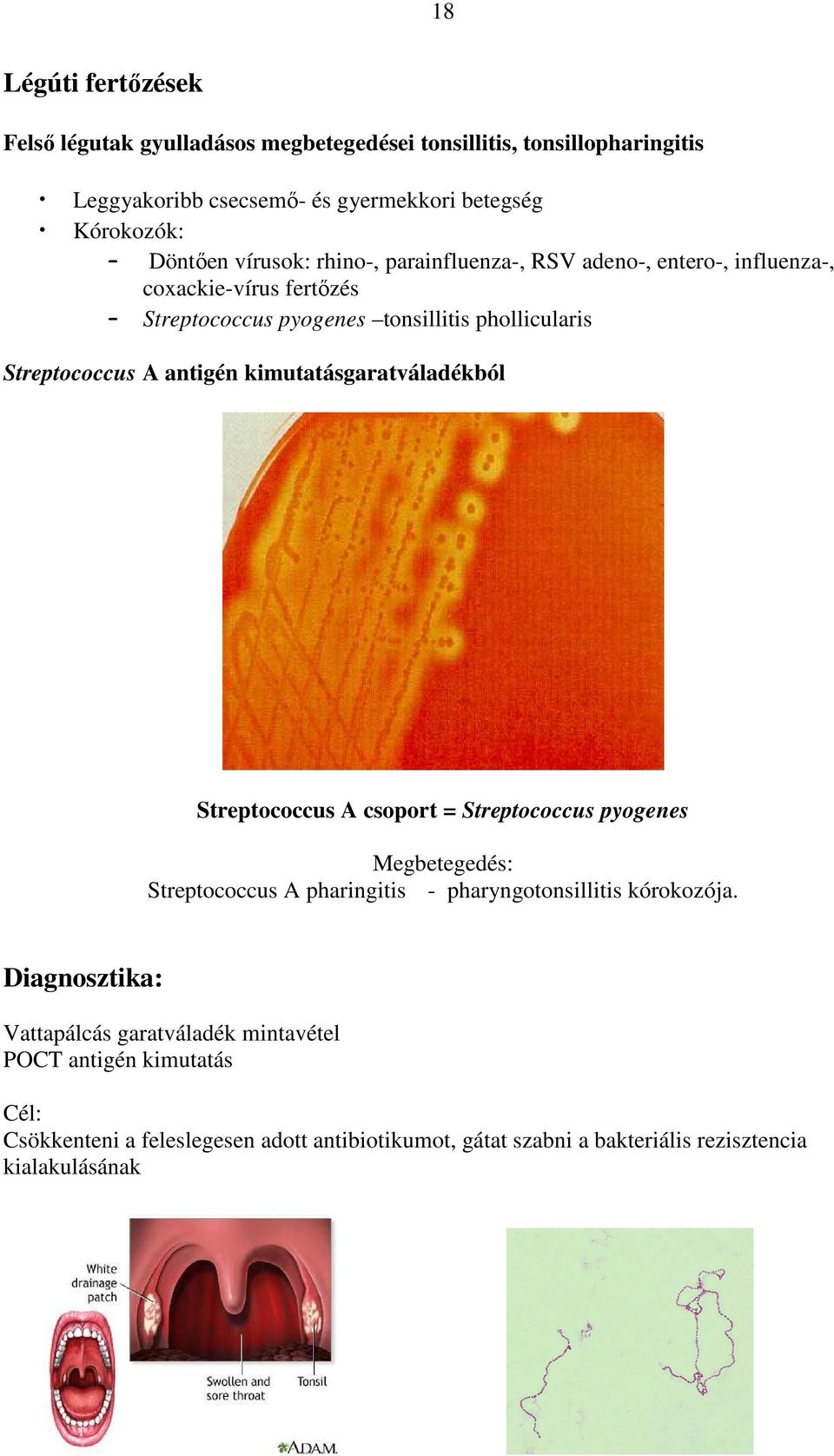 kimutatásgaratváladékból Streptococcus A csoport = Streptococcus pyogenes Megbetegedés: Streptococcus A pharingitis - pharyngotonsillitis kórokozója.