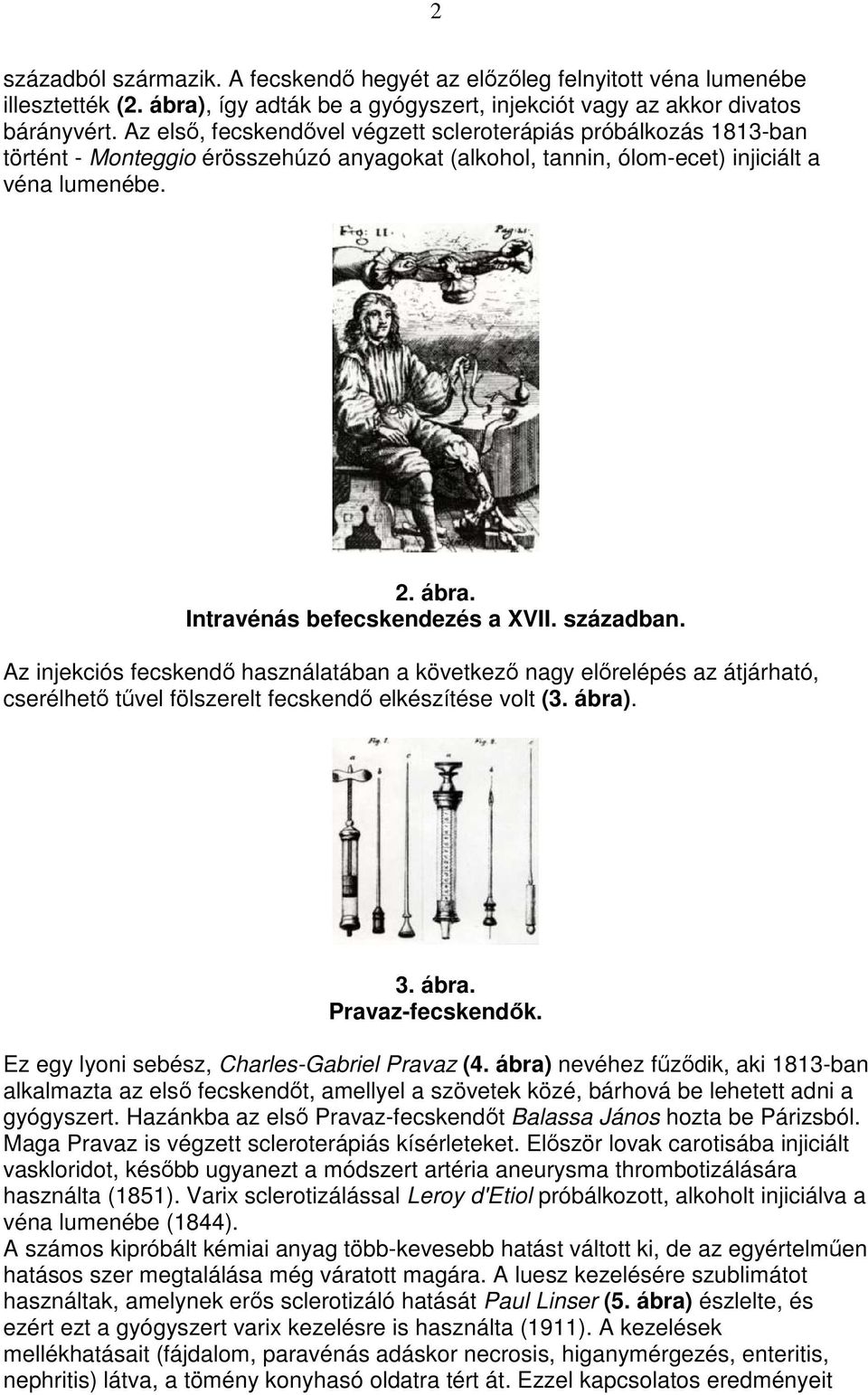 Intravénás befecskendezés a XVII. században. Az injekciós fecskendı használatában a következı nagy elırelépés az átjárható, cserélhetı tővel fölszerelt fecskendı elkészítése volt (3. ábra)
