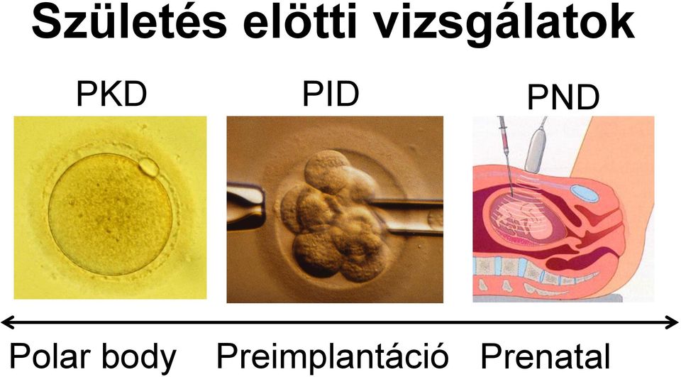 PID PND Polar body