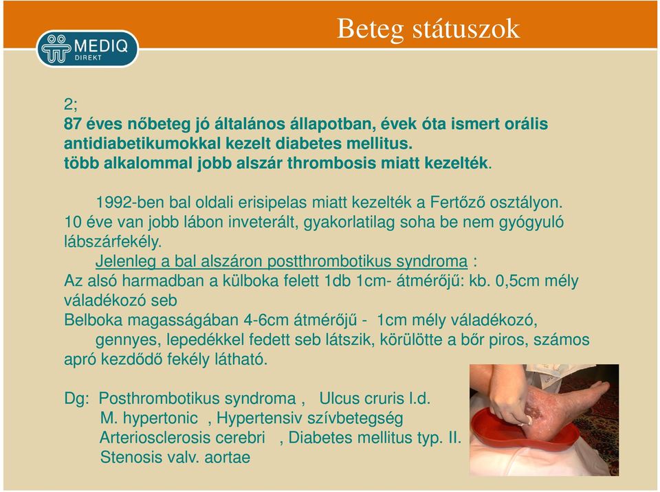 Jelenleg a bal alszáron postthrombotikus syndroma : Az alsó harmadban a külboka felett 1db 1cm- átmérőjű: kb.