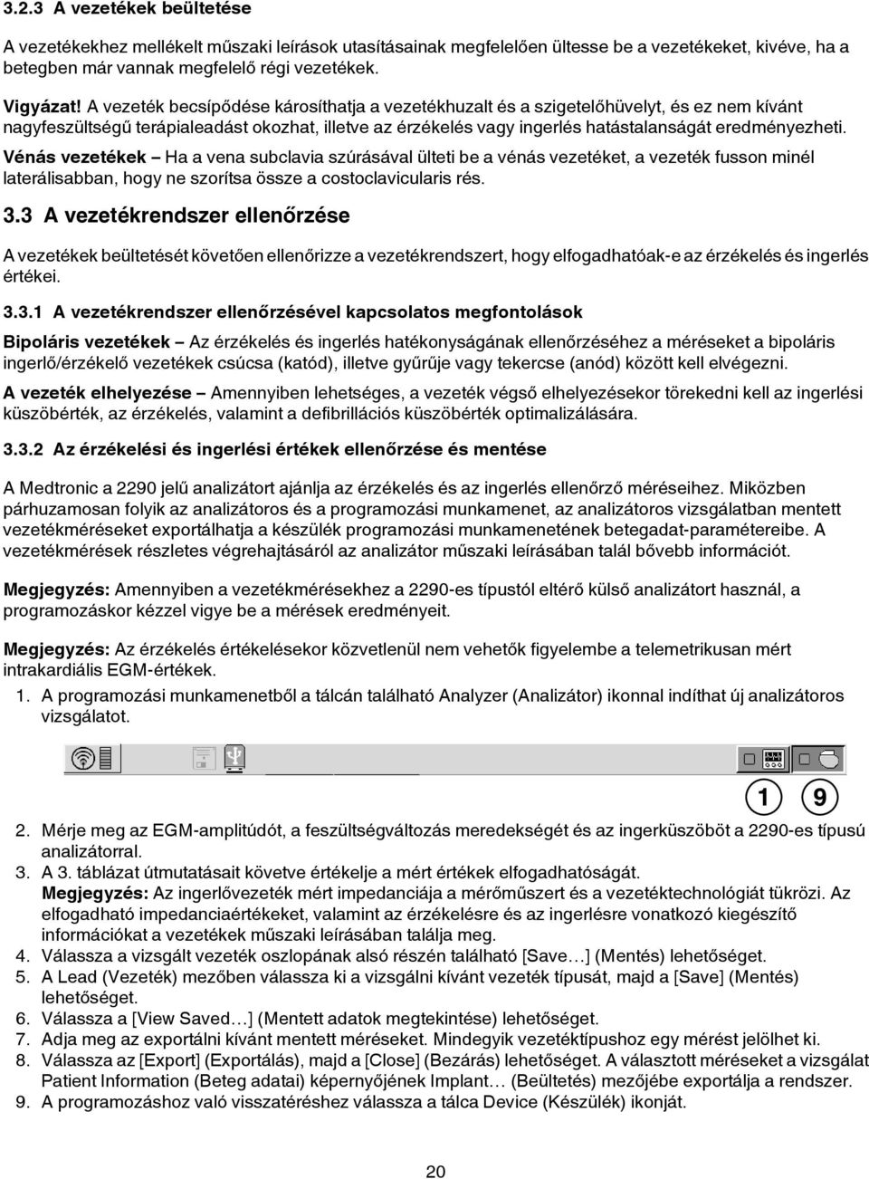 Vénás vezetékek Ha a vena subclavia szúrásával ülteti be a vénás vezetéket, a vezeték fusson minél laterálisabban, hogy ne szorítsa össze a costoclavicularis rés. 3.