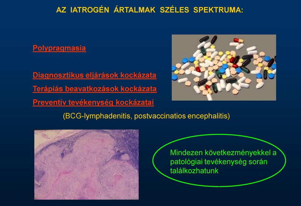 tevékenység kockázatai (BCG-lymphadenitis, postvaccinatios