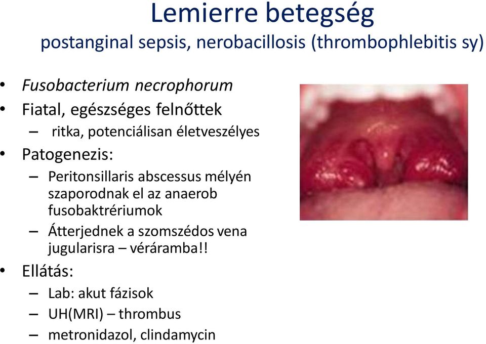 Peritonsillaris abscessus mélyén szaporodnak el az anaerob fusobaktrériumok Átterjednek a