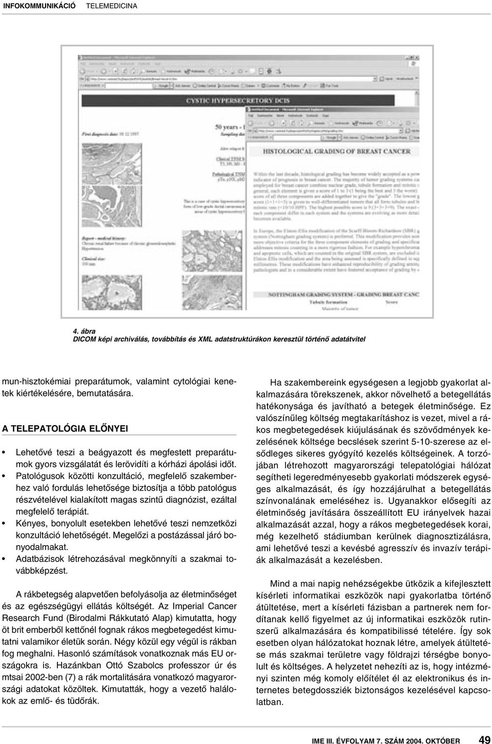 Patológusok közötti konzultáció, megfelelô szakemberhez való fordulás lehetôsége biztosítja a több patológus részvételével kialakított magas szintû diagnózist, ezáltal megfelelô terápiát.