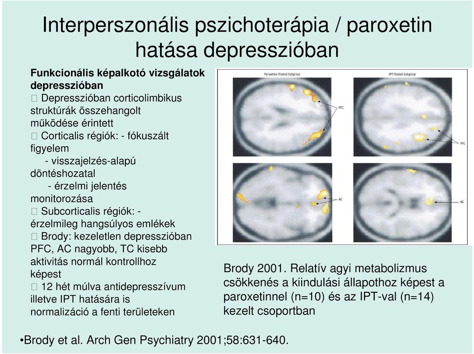 kezeletlen depresszióban PFC, AC nagyobb, TC kisebb aktivitás normál kontrollhoz képest 12 hét múlva antidepresszívum illetve IPT hatására is normalizáció a fenti területeken