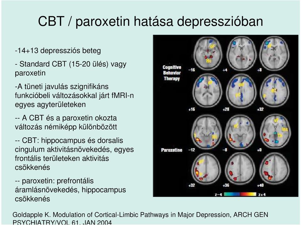 hippocampus és dorsalis cingulum aktivitásnövekedés, egyes frontális területeken aktivitás csökkenés paroxetin: prefrontális