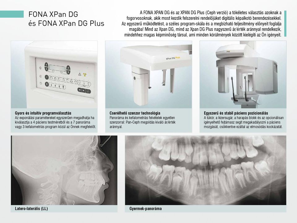 Mind az Xpan DG, mind az Xpan DG Plus nagyszerű ár/érték aránnyal rendelkezik, mindehhez magas képminőség társul, ami minden körülmények között kielégíti az Ön igényeit.