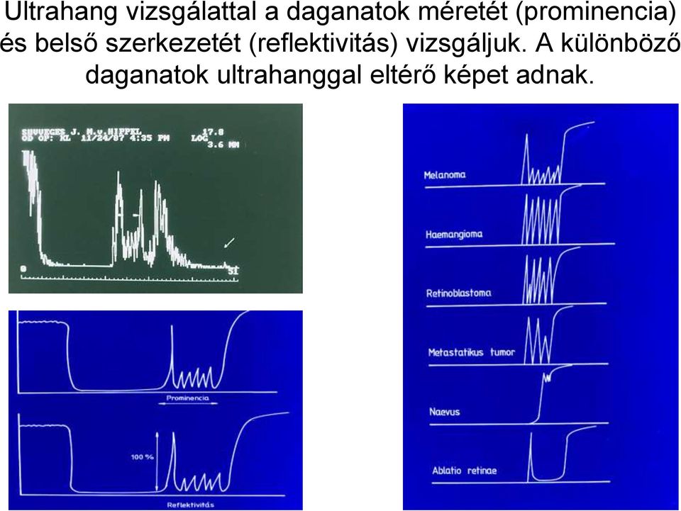 szerkezetét (reflektivitás) vizsgáljuk.