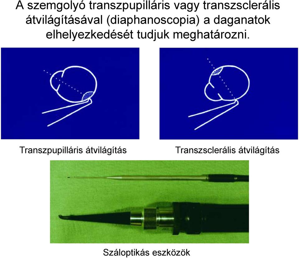 elhelyezkedését tudjuk meghatározni.