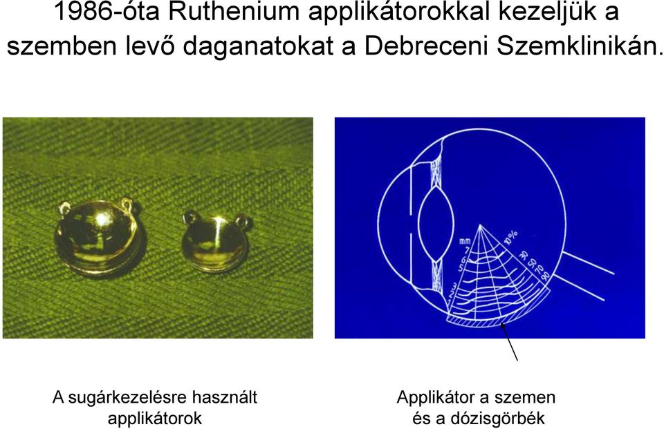 Debreceni Szemklinikán.