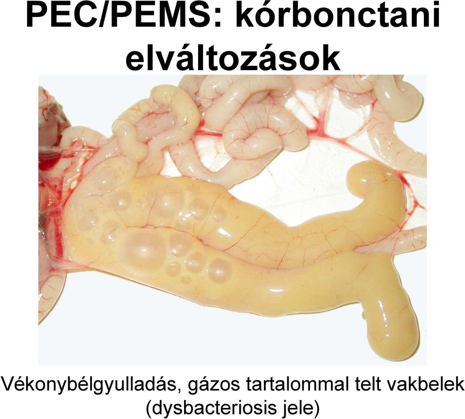 Vékonybélgyulladás, gázos