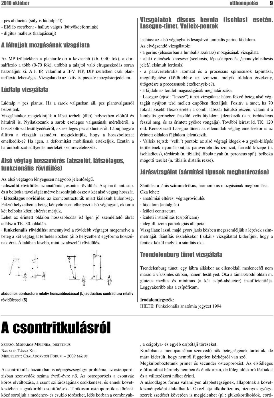 PIP, DIP ízületben csak plantarflexio lehetséges. Vizsgálandó az aktív és passzív mozgásterjedelem. Lúdtalp vizsgálata Lúdtalp = pes planus. Ha a sarok valgusban áll, pes planovalgusról beszélünk.