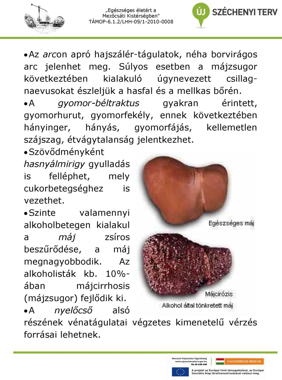 A gyomor-béltraktus gyakran érintett, gyomorhurut, gyomorfekély, ennek következtében hányinger, hányás, gyomorfájás, kellemetlen szájszag, étvágytalanság jelentkezhet.