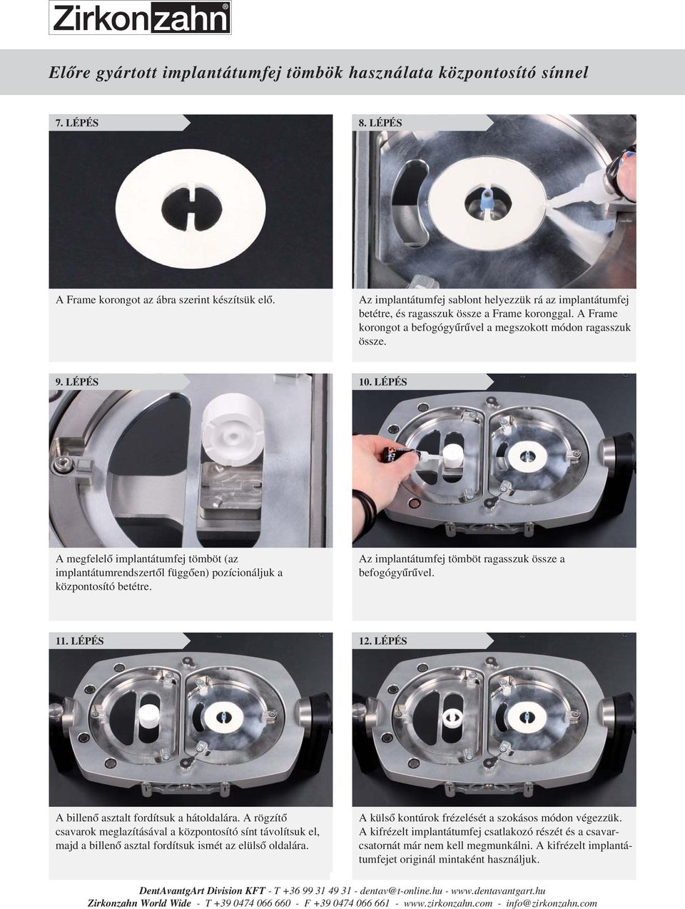 LÉPÉS A megfelelő implantátumfej tömböt (az implantátumrendszertől függően) pozícionáljuk a központosító betétre. Az implantátumfej tömböt ragasszuk össze a befogógyűrűvel. 11. LÉPÉS 12.
