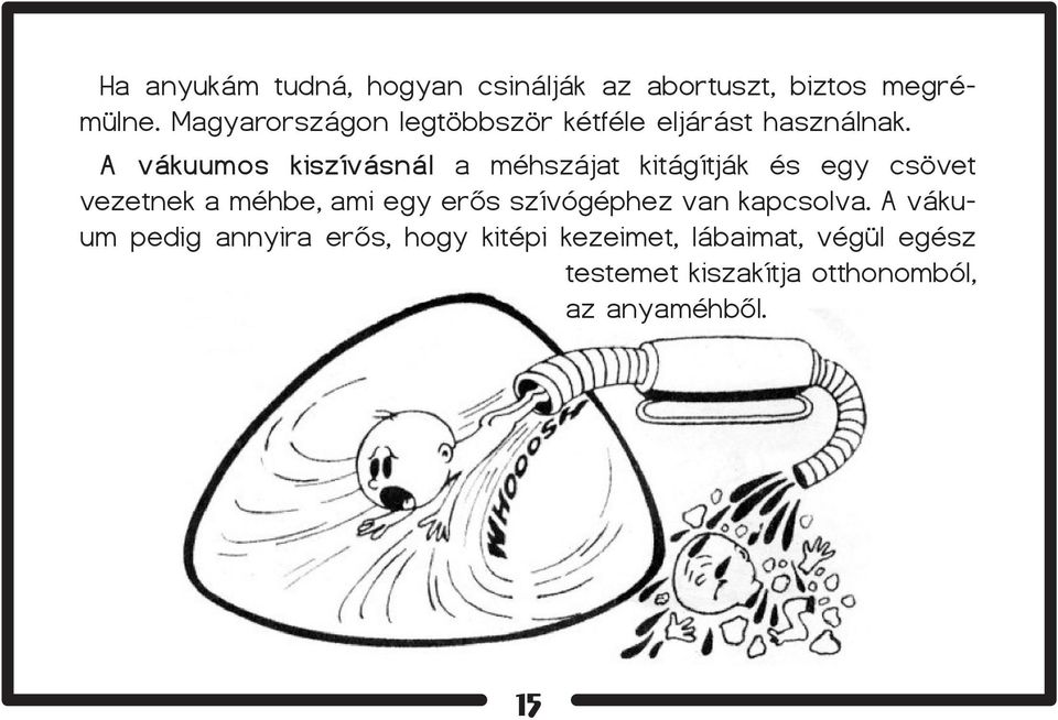 A vákuumos kiszívásnál a méhszájat kitágítják és egy csövet vezetnek a méhbe, ami egy erős