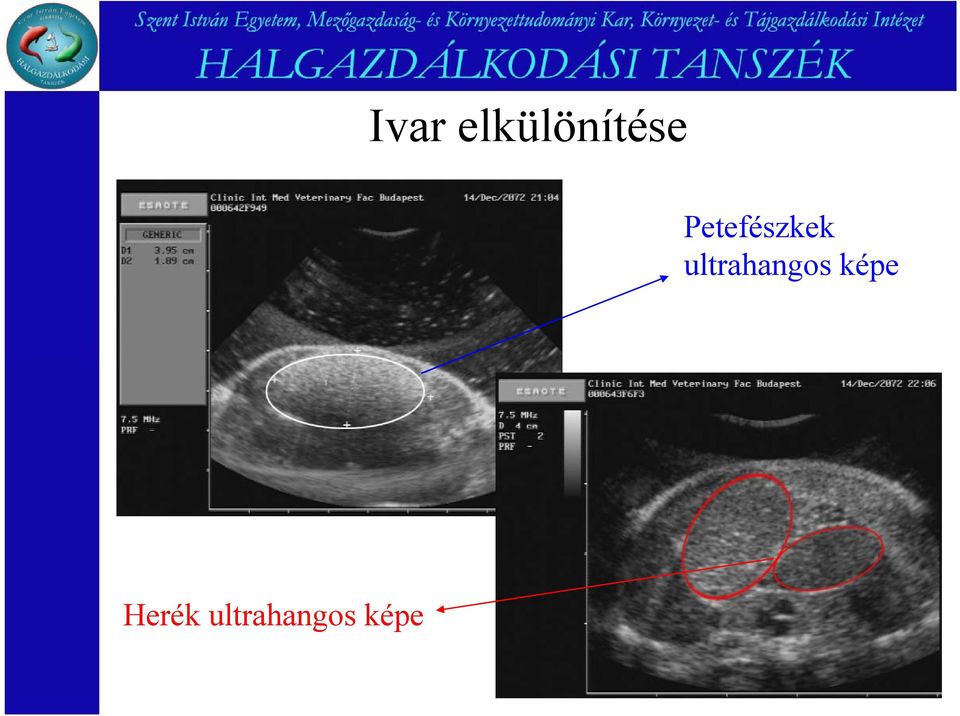 ultrahangos képe