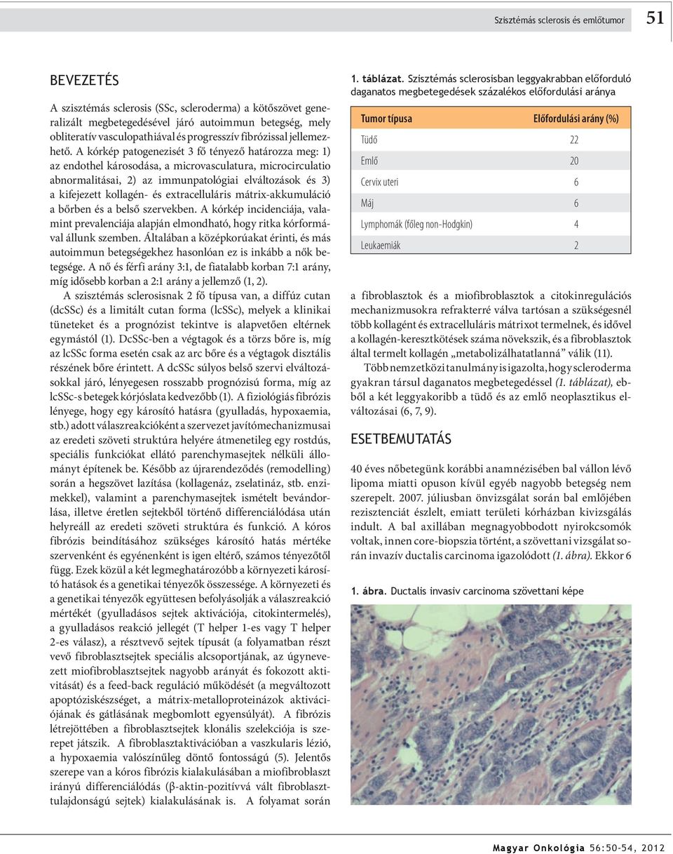 A kórkép ptogenezisét 3 fő tényező htározz meg: 1) z endothel károsodás, microvscultur, microcircultio normlitási, 2) z immunptológii elváltozások és 3) kifejezett kollgén- és extrcelluláris