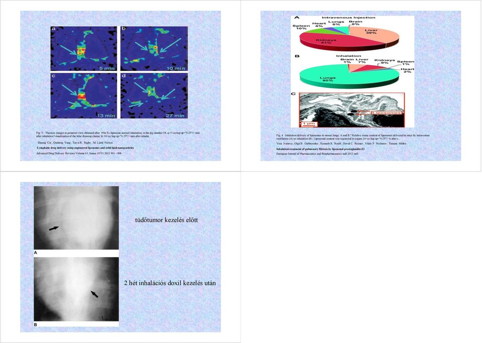 Laird Forrest Lymphatic drug delivery using engineered liposomes and solid lipid nanoparticles Advanced Drug Delivery Reviews Volume 63, Issues 10?11 2011 901-908 Fig.