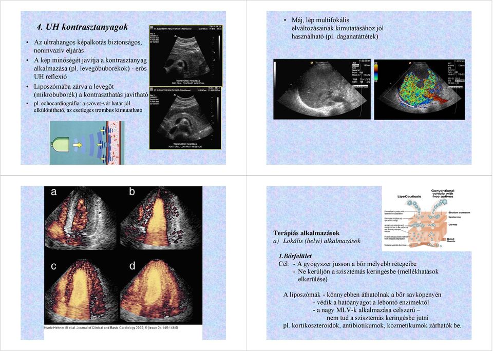 echocardiográfia: a szövet-vér határ jól elkülöníthető, az esetleges trombus kimutatható Máj, lép multifokális elváltozásainak kimutatásához jól használható (pl.