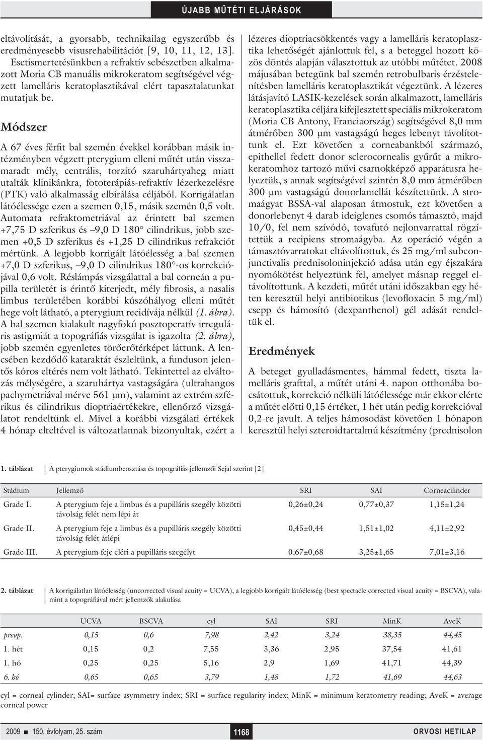 Módszer A 67 éves férfit bal szemén évekkel korábban másik intézményben végzett pterygium elleni műtét után visszamaradt mély, centrális, torzító szaruhártyaheg miatt utalták klinikánkra,