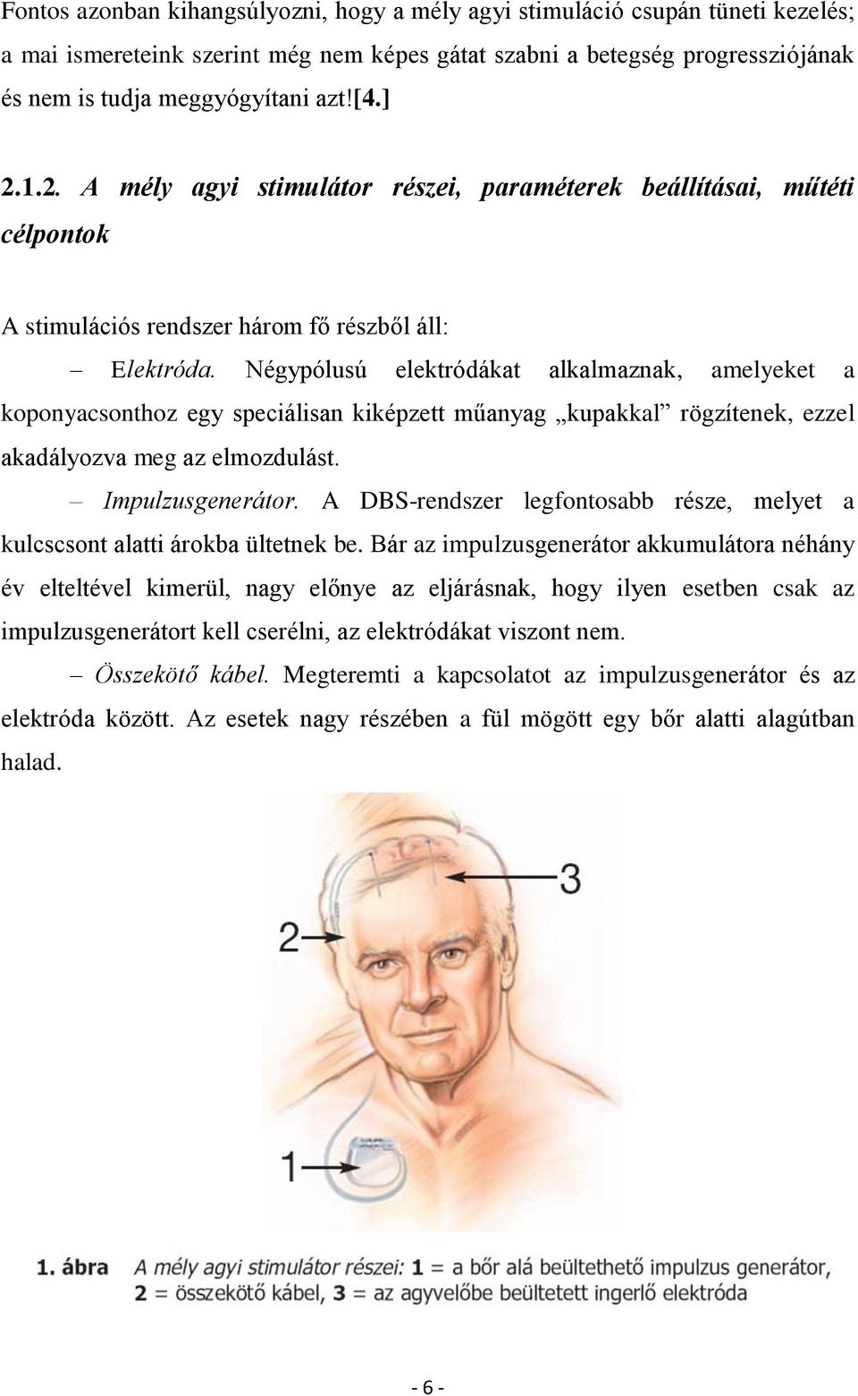 Négypólusú elektródákat alkalmaznak, amelyeket a koponyacsonthoz egy speciálisan kiképzett műanyag kupakkal rögzítenek, ezzel akadályozva meg az elmozdulást. Impulzusgenerátor.