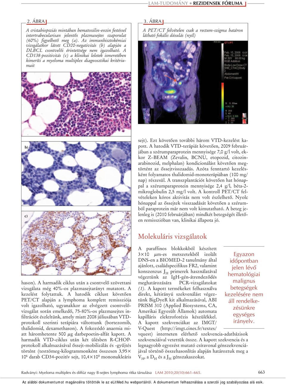 A CD138-pozitivitás (c) a klinikai leletek ismeretében kimeríti a myeloma multiplex diagnosztikai kritériumait 3.