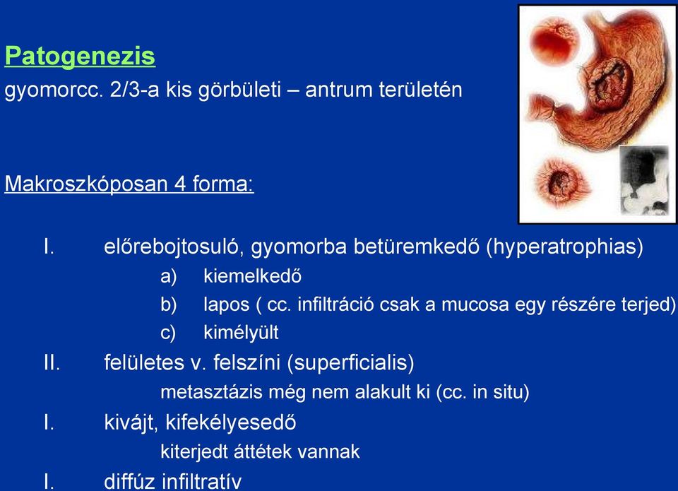 infiltráció csak a mucosa egy részére terjed) c) kimélyült II. felületes v.