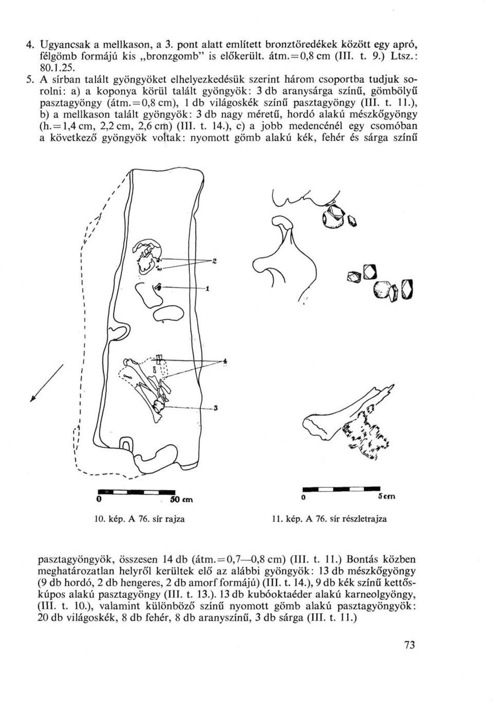 = 0,8 cm), 1 db világoskék színű pasztagyöngy (III. t. 11.), b) a mellkason talált gyöngyök : 3 db nagy méretű, hordó alakú mészkőgyöngy (h.= l,4cm, 2,2 cm, 2,6 cift) (III. t. 14.