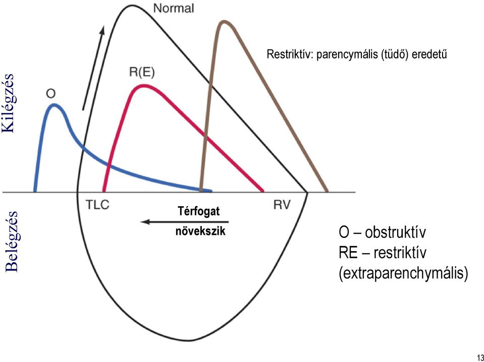 Térfogat növekszik O obstruktív
