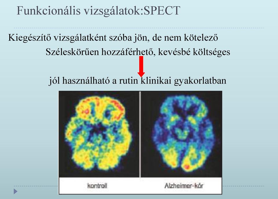 Széleskörűen hozzáférhető, kevésbé