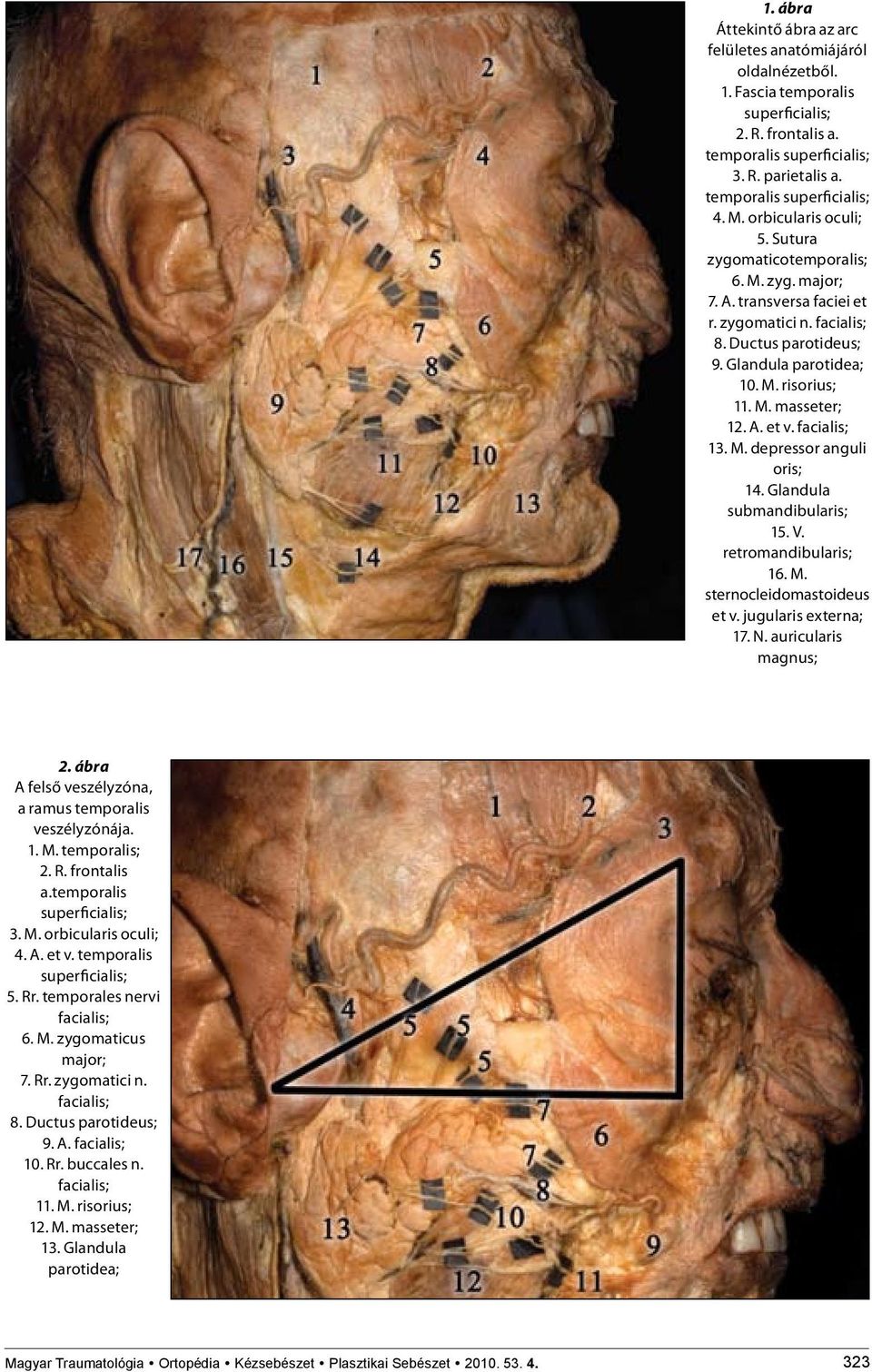 A. et v. facialis; 13. M. depressor anguli oris; 14. Glandula submandibularis; 15. V. retromandibularis; 16. M. sternocleidomastoideus et v. jugularis externa; 17. N. auricularis magnus; 2.