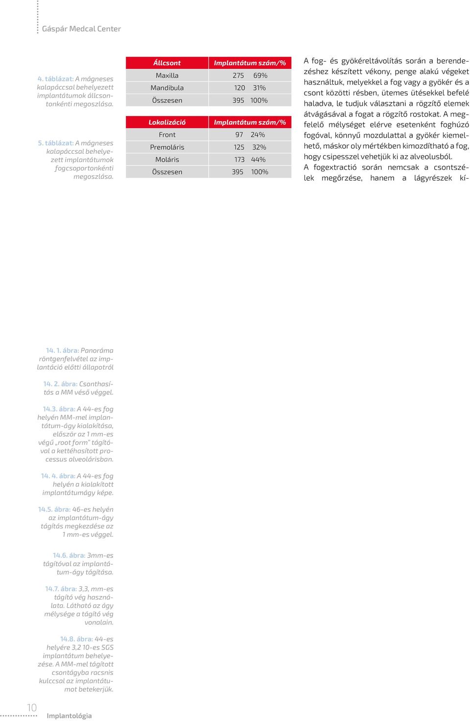 Állcsont Implantátum szám/% Maxilla 275 69% Mandibula 120 31% Összesen 395 100% Lokalizáció Implantátum szám/% Front 97 24% Premoláris 125 32% Moláris 173 44% Összesen 395 100% A fog- és