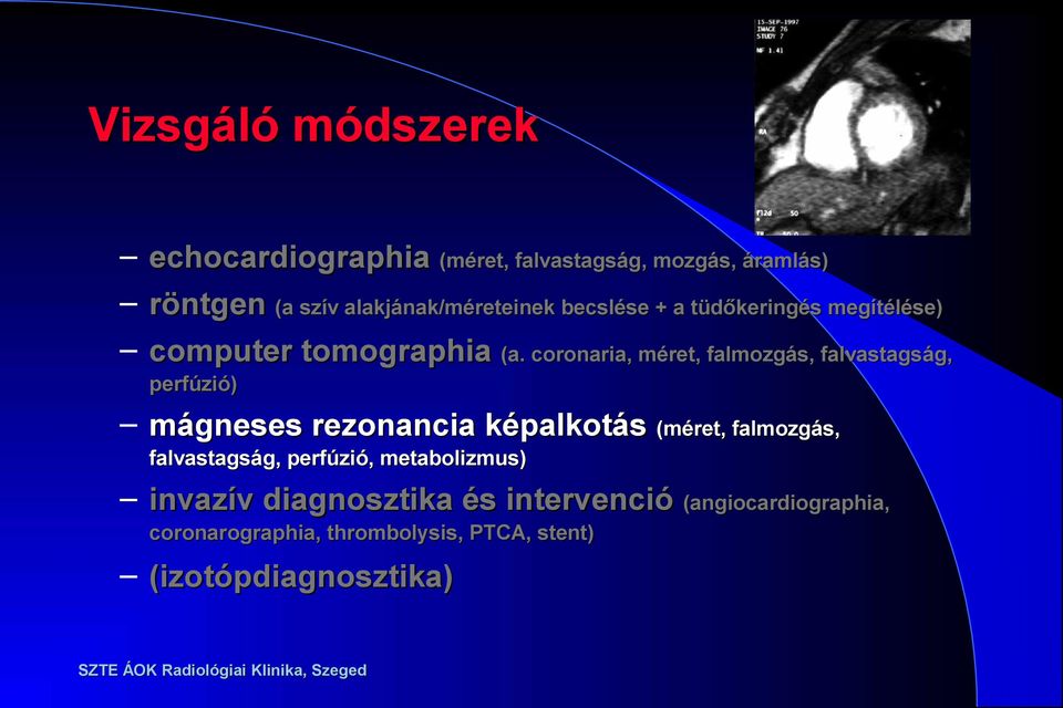 coronaria, méret, falmozgás, falvastagság, perfúzió) mágneses rezonancia képalkotás (méret, falmozgás,