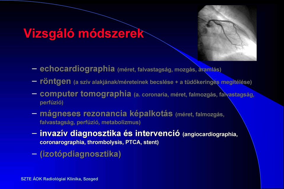 coronaria, méret, falmozgás, falvastagság, perfúzió) mágneses rezonancia képalkotás (méret, falmozgás,