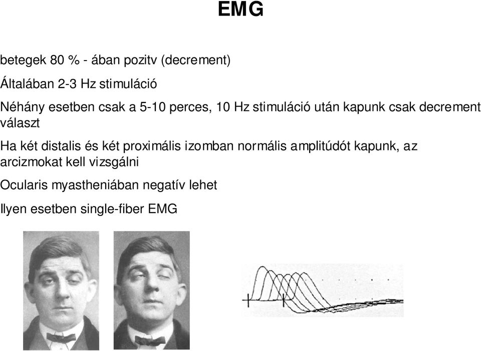 Ha két distalis és két proximális izomban normális amplitúdót kapunk, az