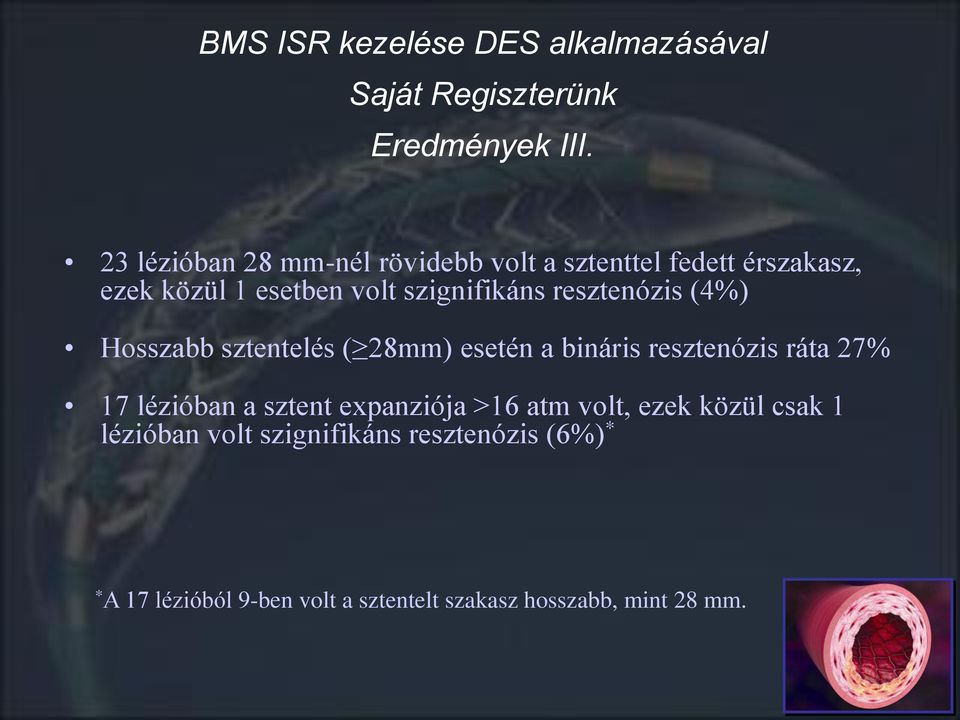 resztenózis (4%) Hosszabb sztentelés ( 28mm) esetén a bináris resztenózis ráta 27% 17 lézióban a sztent