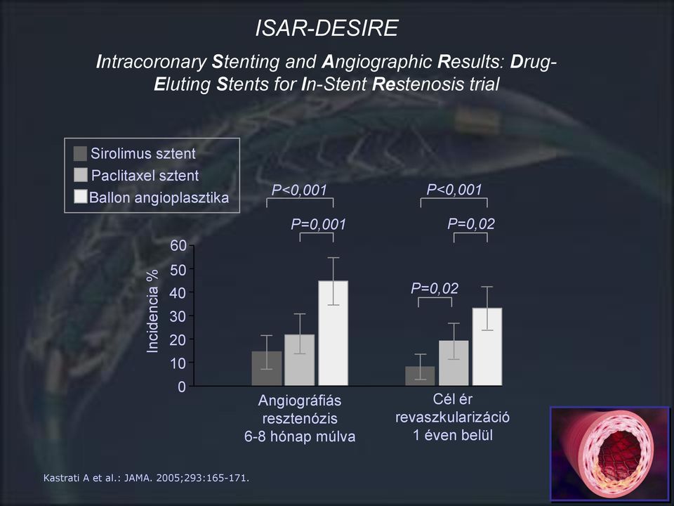 angioplasztika P<0,001 P<0,001 60 50 40 30 20 10 0 P=0,001 Angiográfiás resztenózis 6-8