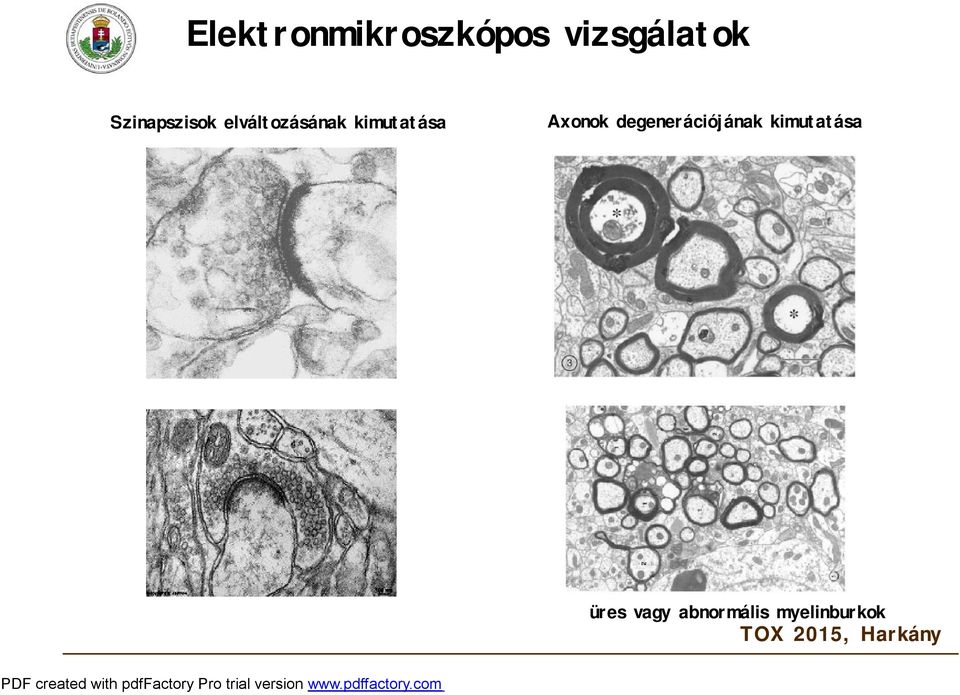 kimutatása Axonok degenerációjának