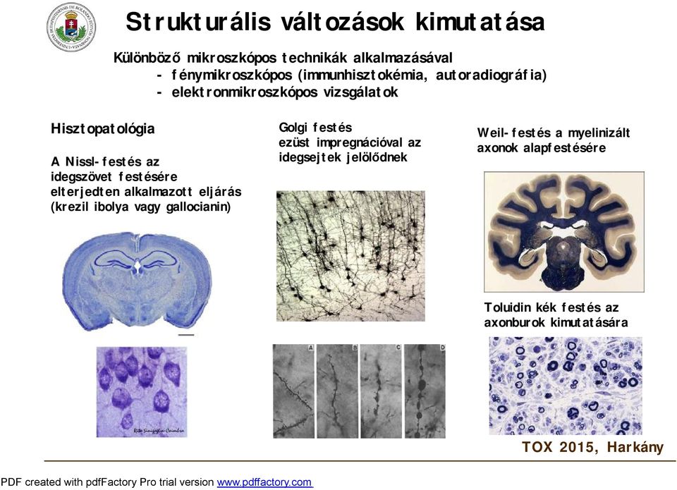 idegszövet festésére elterjedten alkalmazott eljárás (krezil ibolya vagy gallocianin) Golgi festés ezüst