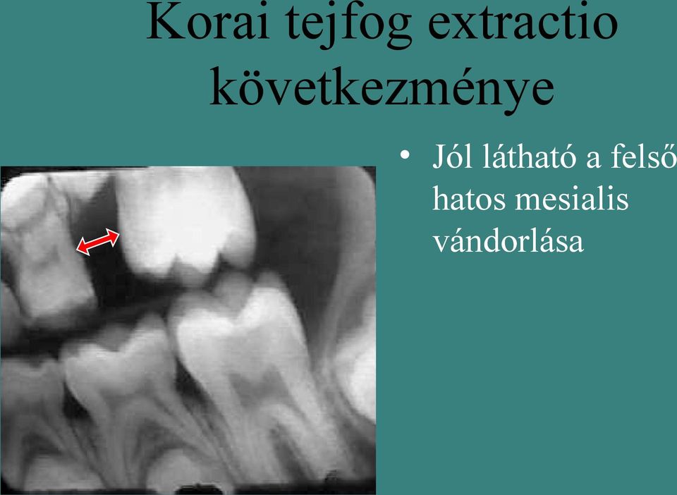 következménye Jól