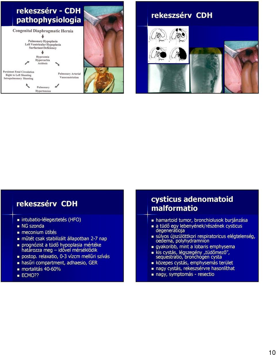 ? cysticus adenomatoid malformatio hamartoid tumor, bronchiolusok burjánz nzása a tüdőt egy lebenyének/r nek/részének cysticus degeneratioja súlyos újszülöttkori respiratoricus elégtelens gtelenség,