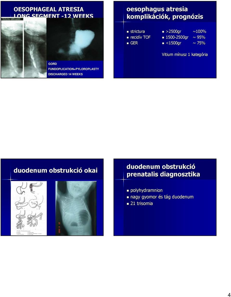 kategória GORD FUNDOPLICATION+PYLOROPLASTY DISCHARGED 14 WEEKS duodenum obstrukció okai