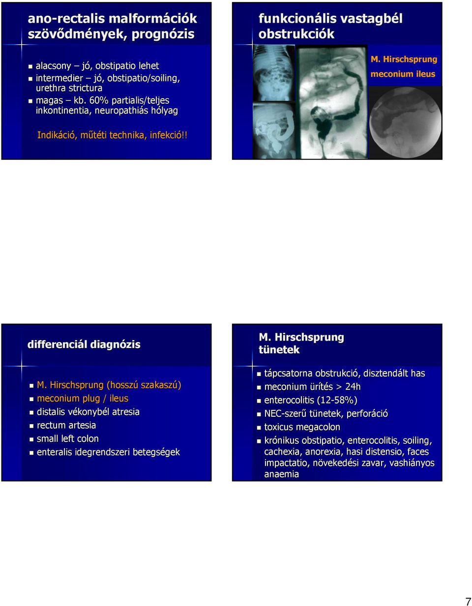 Hirschsprung (hosszú szakaszú) meconium plug / ileus distalis vékonybél atresia rectum artesia small left colon enteralis idegrendszeri betegségek gek M.