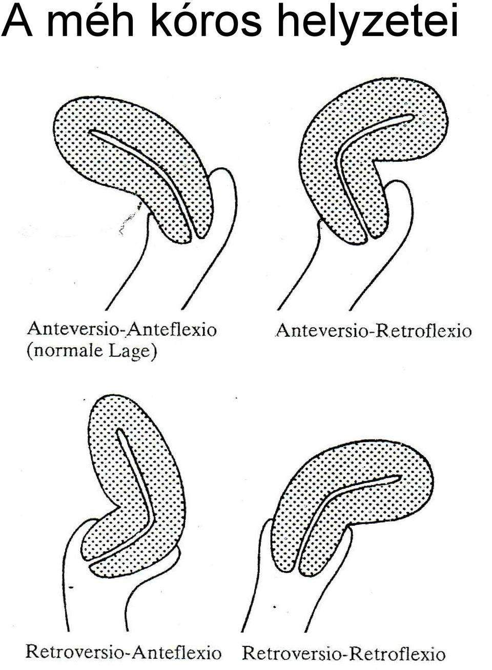 helyzetei