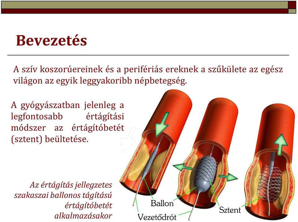 A gyógyászatban jelenleg a legfontosabb értágítási módszer az