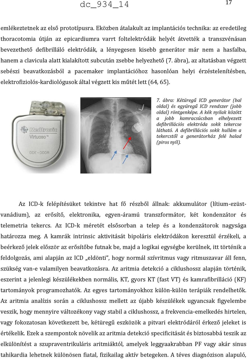 kisebb generátor már nem a hasfalba, hanem a clavicula alatt kialakított subcután zsebbe helyezhető (7.