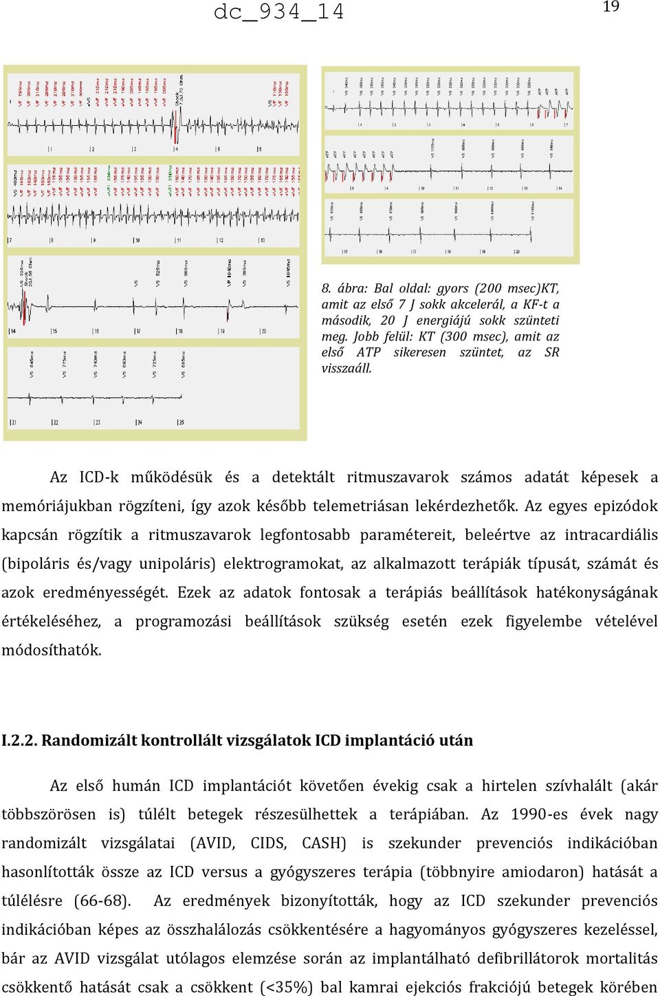 Az ICD-k működésük és a detektált ritmuszavarok számos adatát képesek a memóriájukban rögzíteni, így azok később telemetriásan lekérdezhetők.