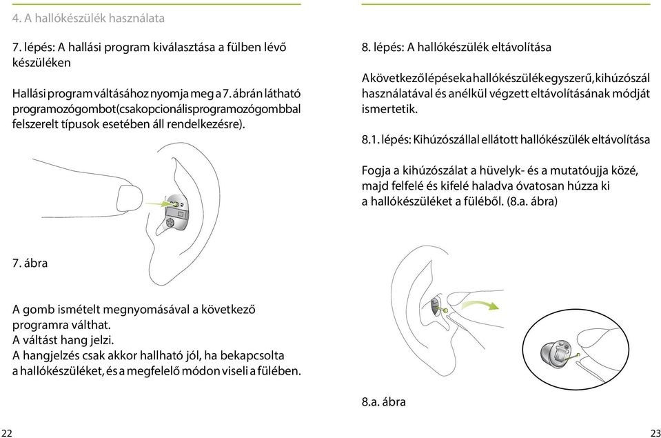 lépés: A hallókészülék eltávolítása A következő lépések a hallókészülék egyszerű, kihúzószál használatával és anélkül végzett eltávolításának módját ismertetik. 8.1.