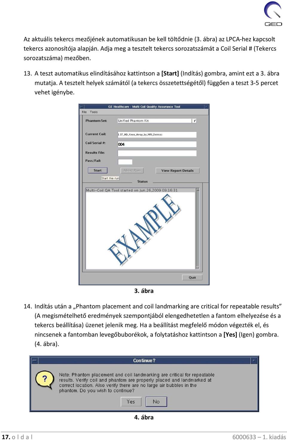 A tesztelt helyek számától (a tekercs összetettségétől) függően a teszt 3-5 percet vehet igénybe. 3. ábra 14.